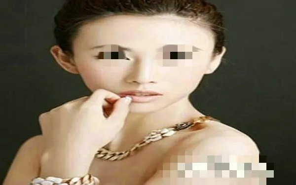 玻尿酸除皱价格