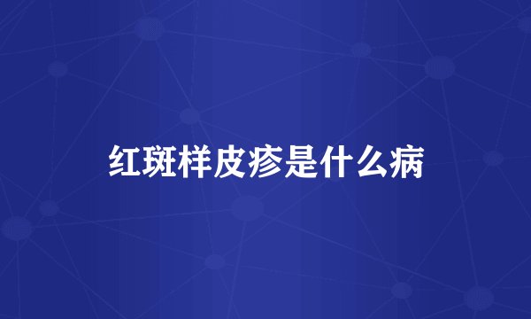 红斑样皮疹是什么病