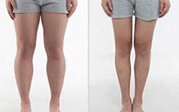 瘦小腿方法