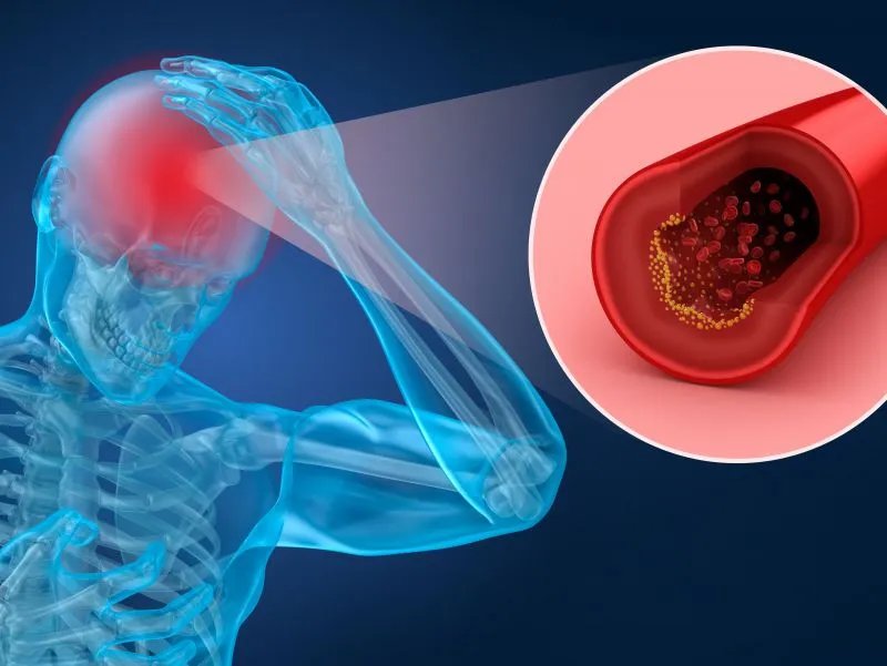 同型半胱氨酸低是怎么回事