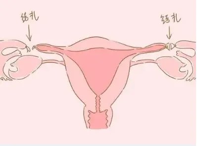 三代试管哪个医院好-成都市妇女儿童中心医院和华西附属第二医院,哪个做试管比较好?