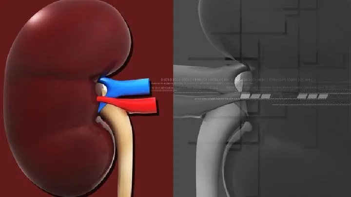 肾积水有哪些常见的症状
