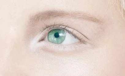 双眼皮整形坏处