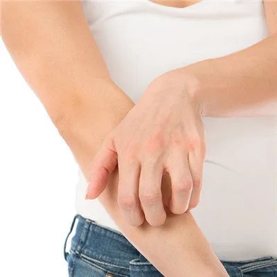 过敏性皮炎症状