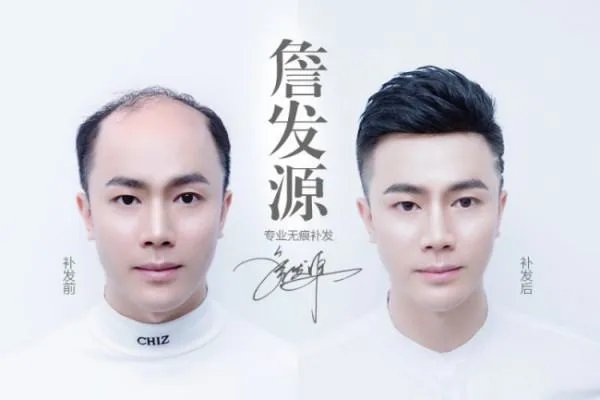 一个假发套大概要多少钱啊？