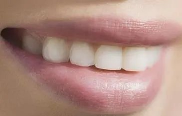 烤瓷牙的寿命是几年