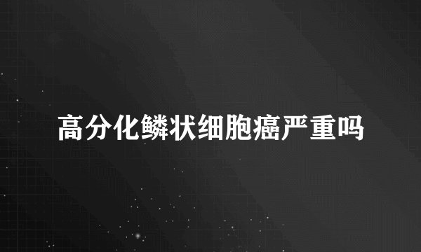 高分化鳞状细胞癌严重吗