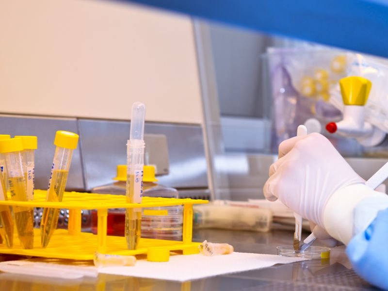 尿蛋白2+代表什么