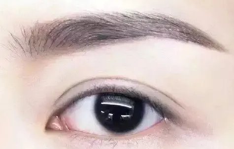 双眼皮手术价格一般是多少