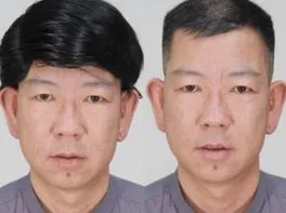 男士假发是怎么固定的？