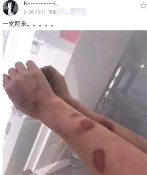 黄景瑜回应家暴:有没有家暴是什么情况揭开(图)