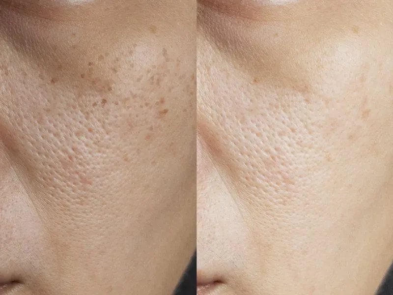 男生如何可以快速美白