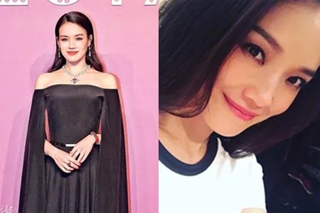 舒淇自曝曾被嫌丑 晒过敏照片令人心疼