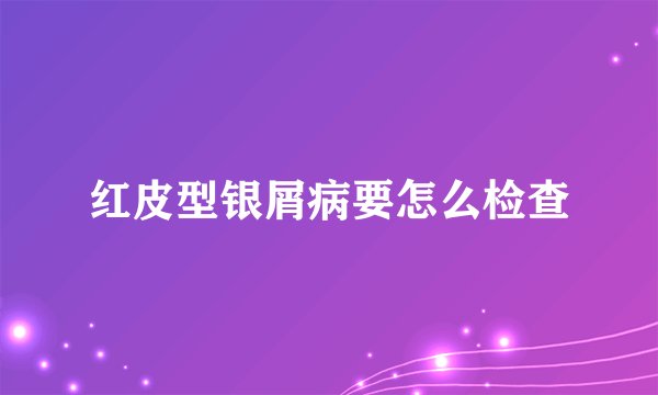 红皮型银屑病要怎么检查