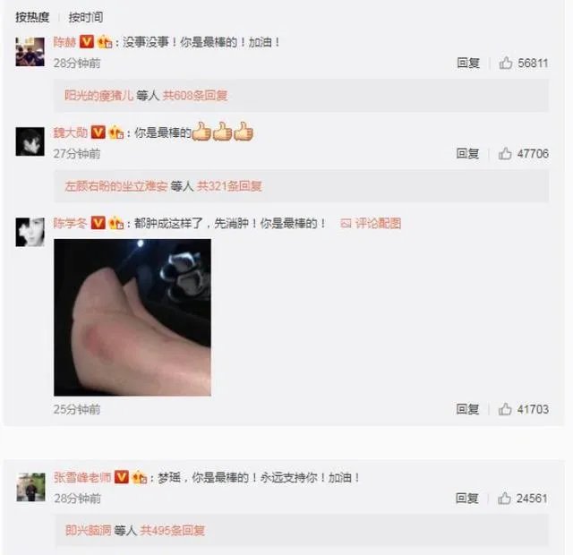 2017维秘秀奚梦瑶摔倒，你怎么看？