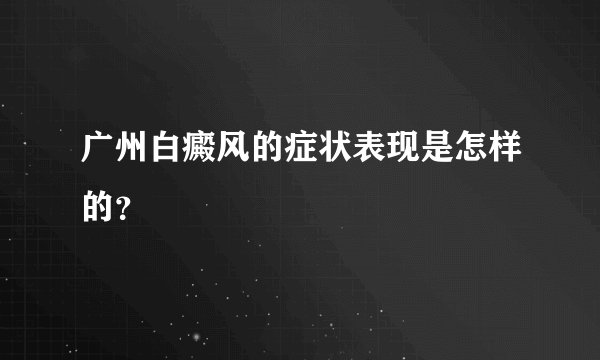 广州白癜风的症状表现是怎样的？