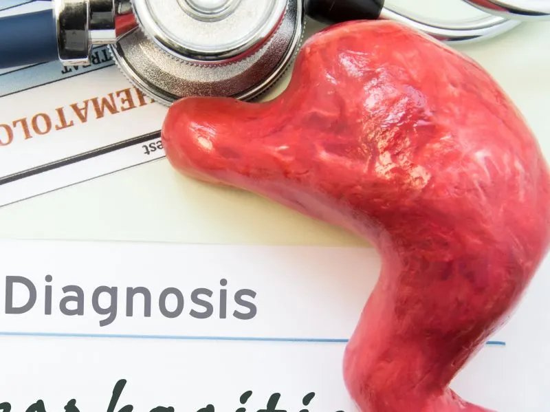 食管炎的早期症状