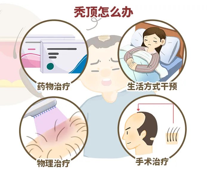 秃顶怎么办
