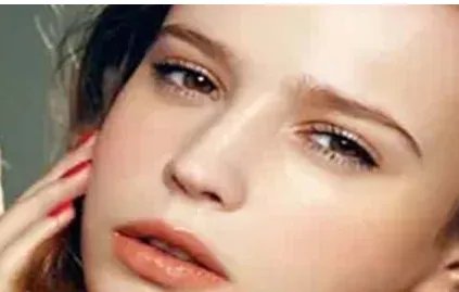 广州哪家医院隆鼻修复口碑好