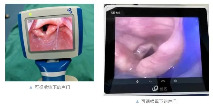 厉害了！广医五院麻醉科医生竟有“第三只眼”，引领“舒适化诊疗”新体验！