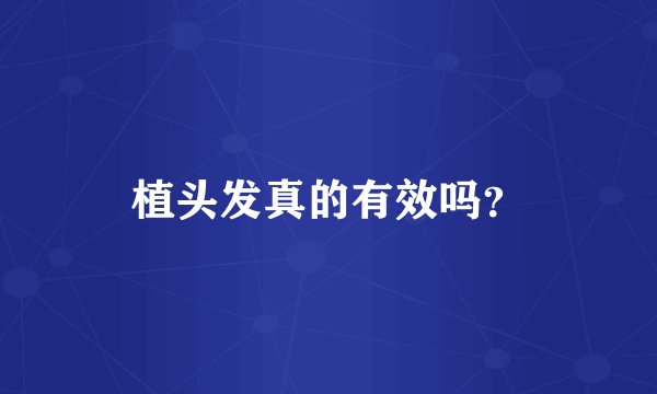 植头发真的有效吗？