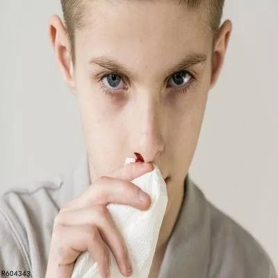 甲型血友病是怎么引起的