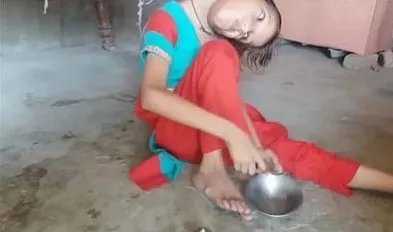 8岁女孩头部无法竖立是怎么回事?