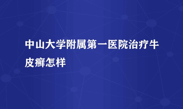 中山大学附属第一医院治疗牛皮癣怎样