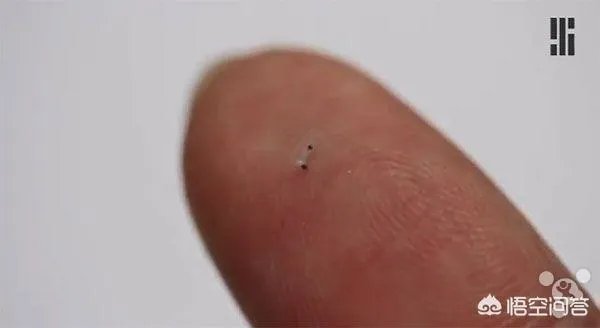 在未来,能做全身的血管支架手术吗?