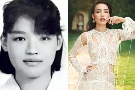 舒淇自曝曾被嫌丑 晒过敏照片令人心疼