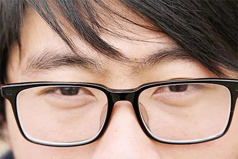 超高度近视怎么办