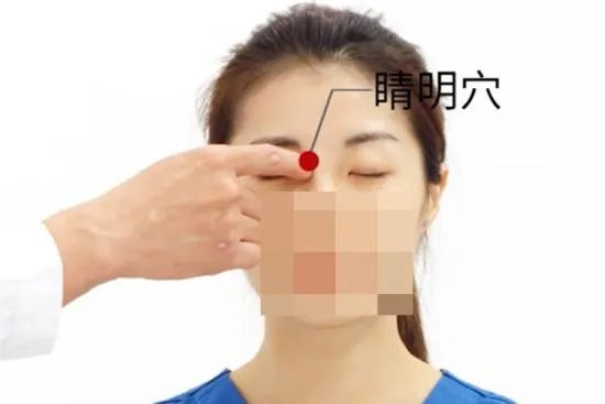 睛明作用和准确位置图