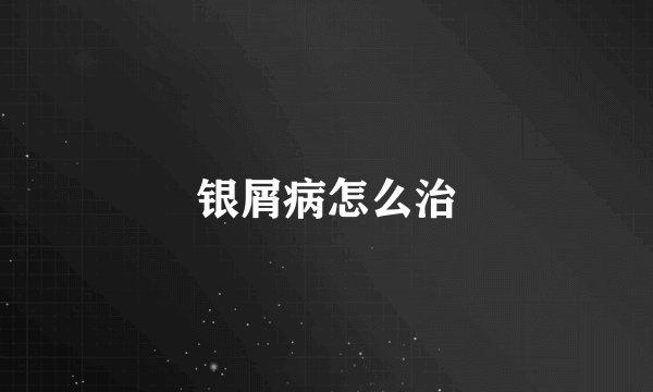 银屑病怎么治