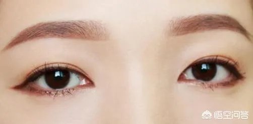 全切双眼皮过程如何？