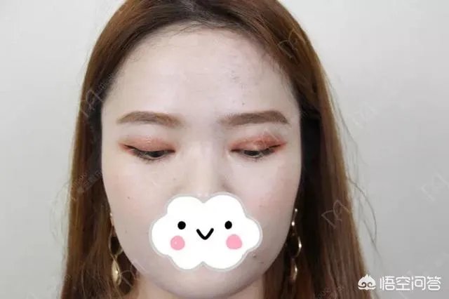 做双眼皮有几种方法？