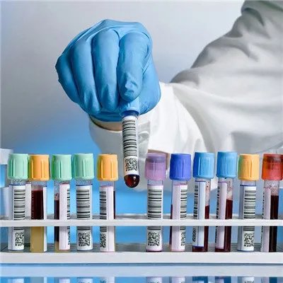 颈淋巴结核症状?