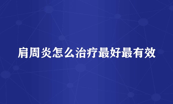 肩周炎怎么治疗最好最有效