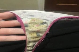 宫颈癌内裤症状图片