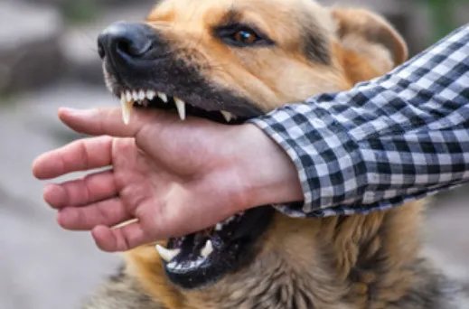 梦见被狗咬是什么意思 梦见被狗咬周公解梦征兆