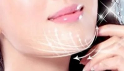 去除双下巴的方法