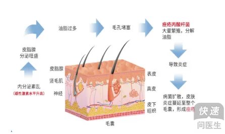 什么药膏祛痘印淡斑效果好？试试奥络