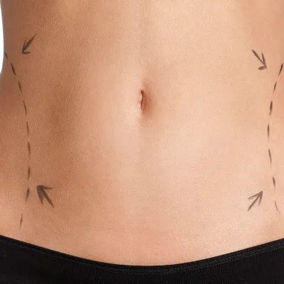 哥本哈根减肥法的食谱是什么？