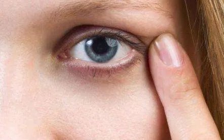 韩式翘睫双眼皮好多钱