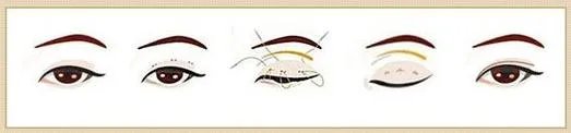做双眼皮有几种方法？