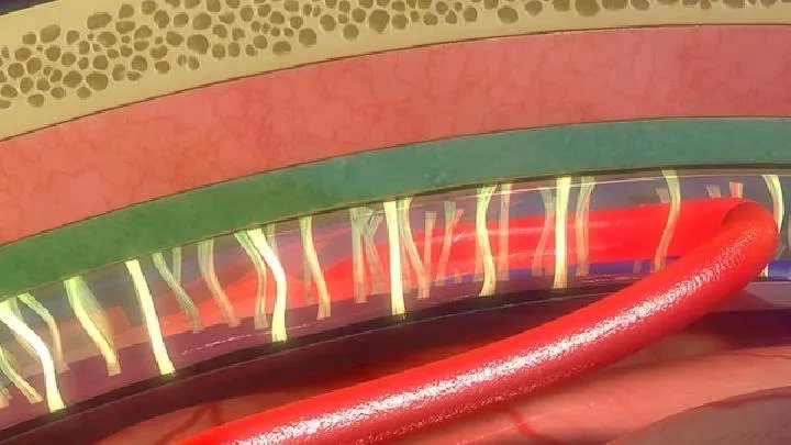 血管性血友病是什么?