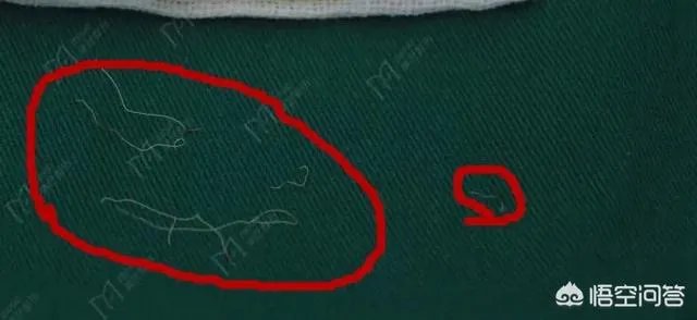 做双眼皮有几种方法？