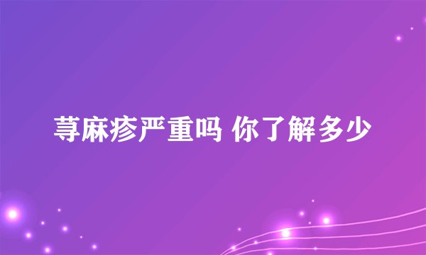 荨麻疹严重吗 你了解多少