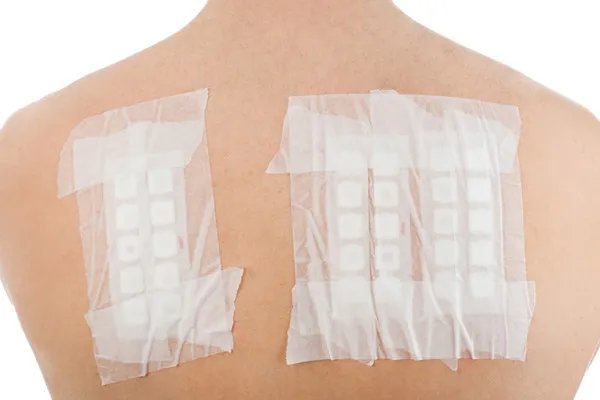 皮肤过敏用什么药