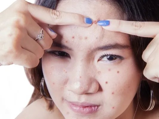 乳牛肝菌的作用