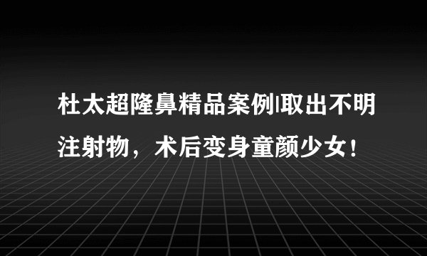 杜太超隆鼻精品案例|取出不明注射物，术后变身童颜少女！
